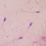 Fertilità degli uomini: crisi dello sperma?