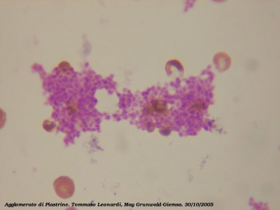 piastrine
