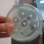 Un batterio intestinale può combattere l’obesità