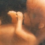 Prima gravidanza con innesto di tessuto ovarico fuori dall’utero