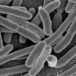 Sequestrato secondo caseificio nel barese: 18 i casi di escherichia coli